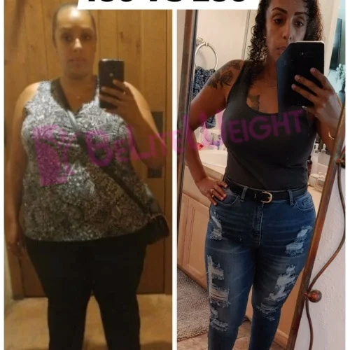 Weight Loss Surgery Before and After Sophia D - 3 Year Update*